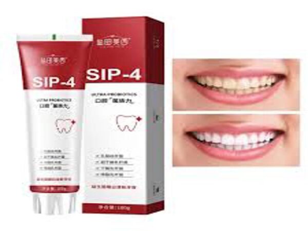 SP04-TEETH WHITENING - Image 3